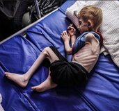 Παγκόσμια Έκθεση: 281 εκατομμύρια άνθρωποι λιμοκτονούν