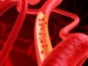 Τεχνητά αιμοφόρα αγγεία από δερματικά κύτταρα κατά του διαβήτη